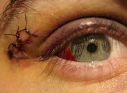 Eye Safety Update - Training Network