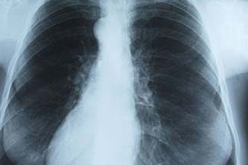 Asbestos Hazards Part 1