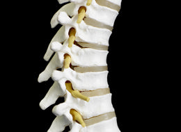 Back Basics - Back Injury Prevention (Healthcare) - Training Network