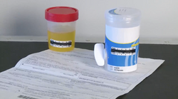 DOT Drug and Alcohol Testing for CDL Drivers