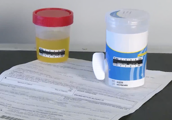 DOT Drug and Alcohol Testing for CDL Drivers