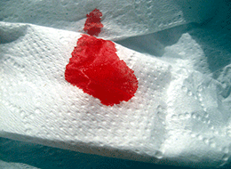 Bloodborne Pathogens for the Hospitality Industry - Training Network