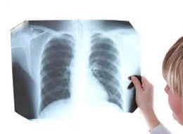 Tuberculosis in the Healthcare Environment - Training Network
