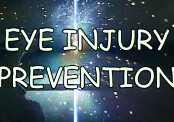 Eye Injury Prevention - Concise
