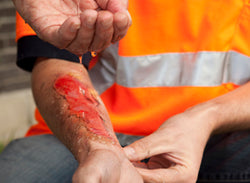 Safety Awareness II - The Gory Story - Training Network